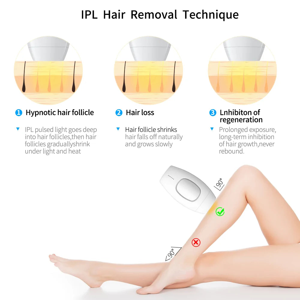 Laser Epilator Hair Removal - WanderMart Co.