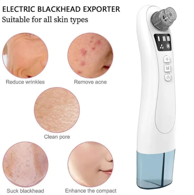 Clear Skin Electric Blackhead Remover - WanderMart Co.